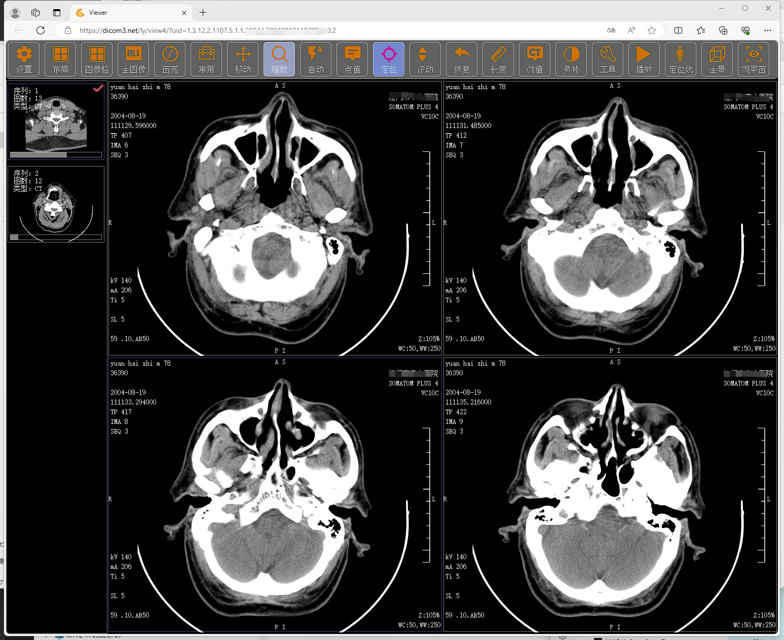 Html5 Dicom Viewer(WebGL)